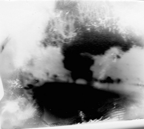 mouth 1