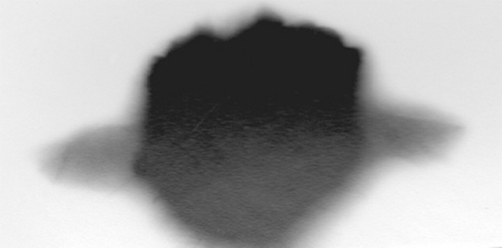 mouth 5